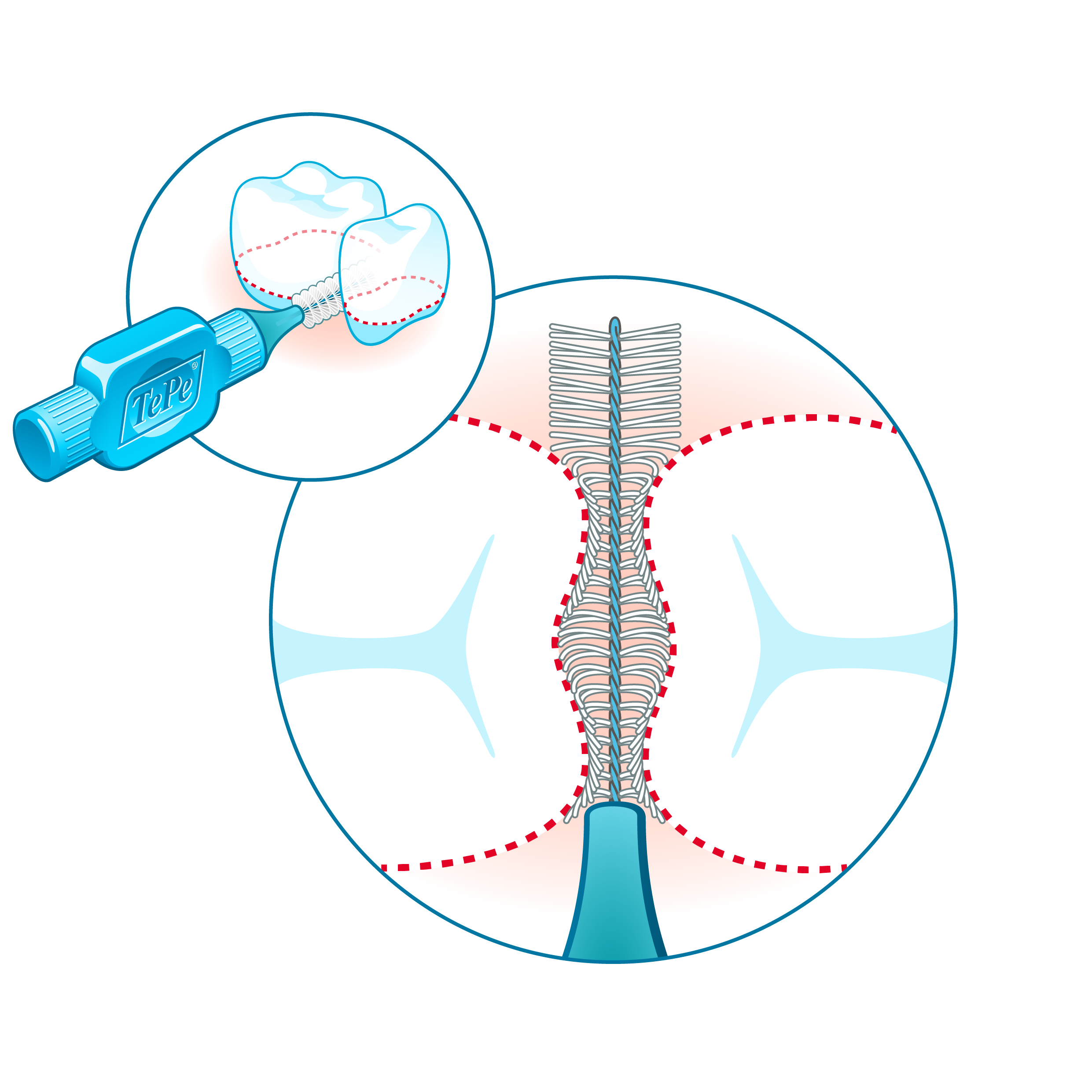 Hygiène bucco dentaire prevention Comment prendre soin de ses dents