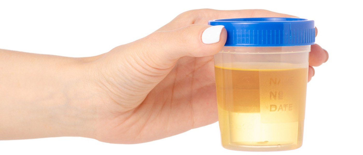 analyse d'urine en cas d'infection urinaire