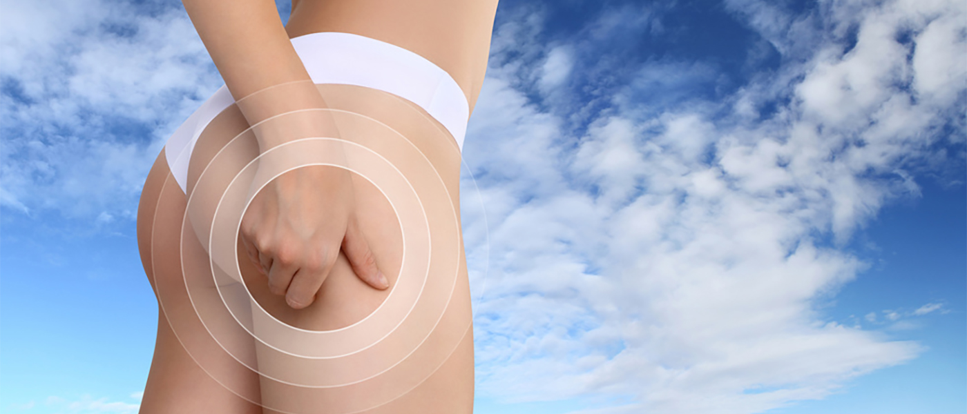 cellulite