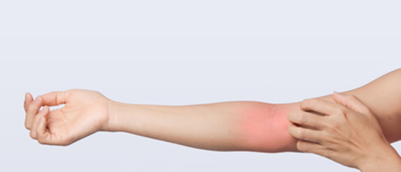 eczema sur le bras