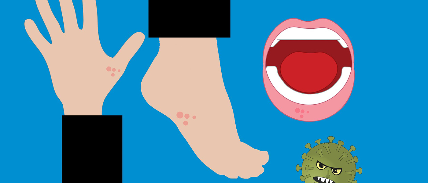 verrue pieds et mains
