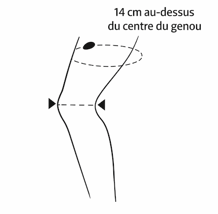 schéma prise de mesure genouillère 