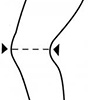 schéma prise de mesure genouillère 