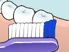 Brosse à dents extra souple Nova TePe - 1 brosse à dents