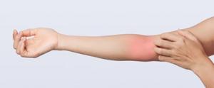 Comment soigner une tendinite de l'avant bras ?
