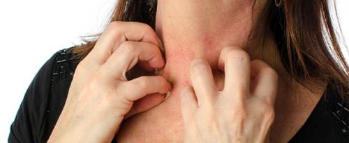 Allergie cutanée : Comment soigner une allergie cutanée ?