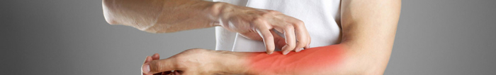 Quelles sont les différentes causes de la dermatite atopique ?