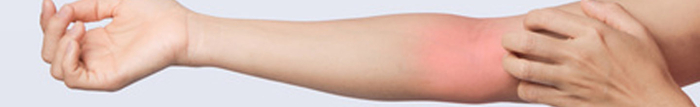 Quels sont les différents types d'eczema ?
